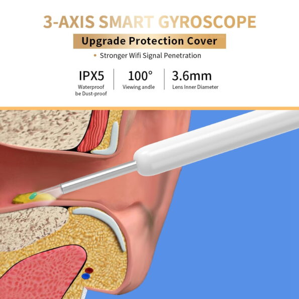 Ear wax removal Ear wax removal